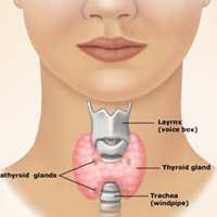 drug induced diabetes treatment